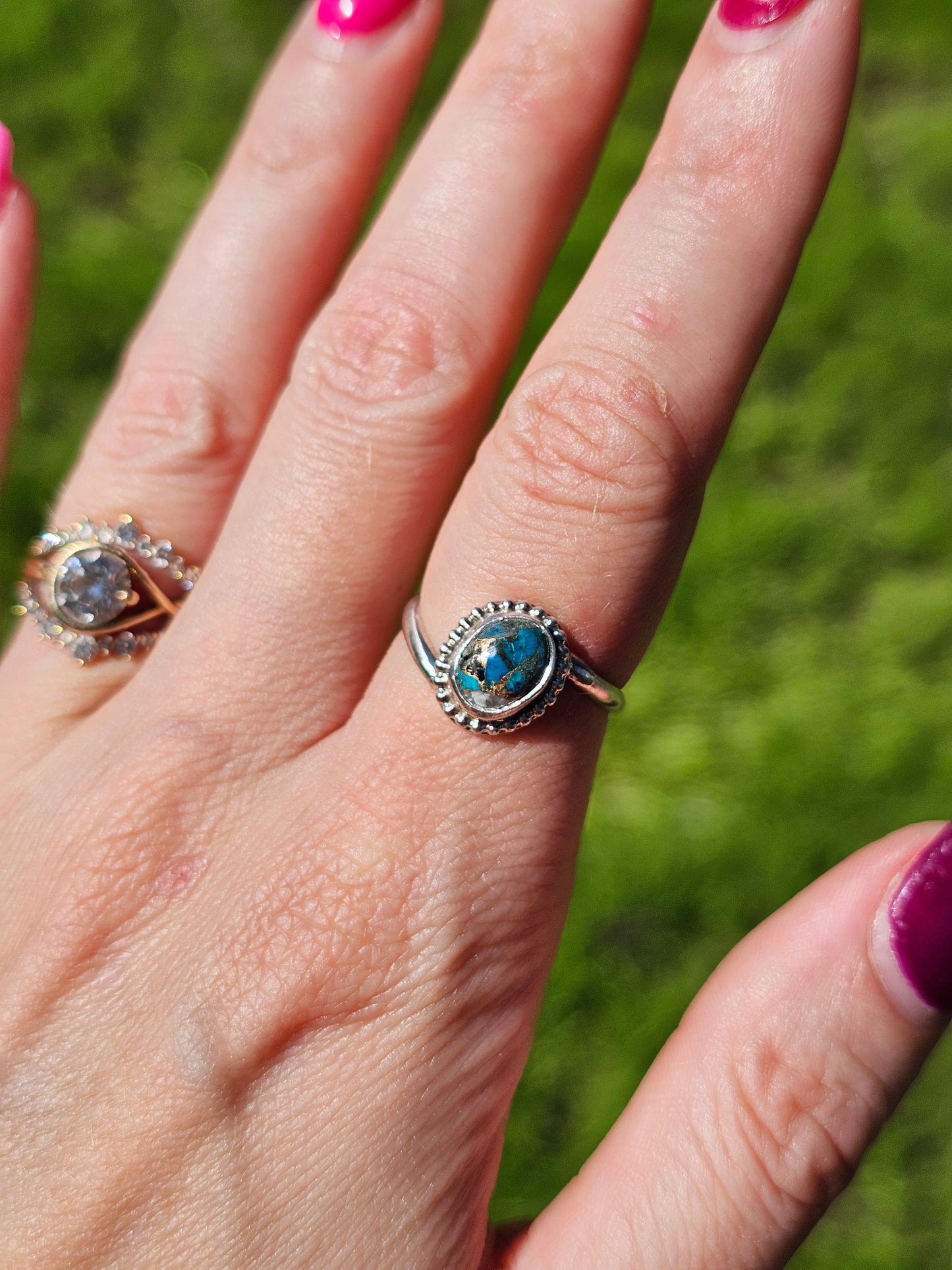 White Buffalo & Kingman Turquoise Ring